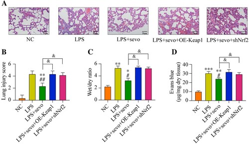 Figure 7. Sevoflurane attenuates ALI by regulating Keap1-Nrf2 signaling pathway. All mice treated with LPS, 3% sevoflurane, and/or local transfected with Keap1 overexpression vector or Nrf2 inhibition vector. Then the lung tissues were collected. (A) The histology of lung tissues, (B) lung injury score, (C) wet/dry of lung tissues, and (D) permeability of lung vasculature were measured, respectively. All data were presented as the mean ± SD. N = 6 in each group. *P < 0.05 and **P < 0.01 vs. NC group. #P < 0.05 and ##P < 0.01 vs. LPS group. &P < 0.05 vs. LPS + sevo group. NC, negative control. LPS, Lipopolysaccharide. Sevo, sevoflurane. Keap1, Kelch-like ECH-related protein 1. C-Nrf2, cytoplasmic-nuclear factor erythroid 2-related factor 2.