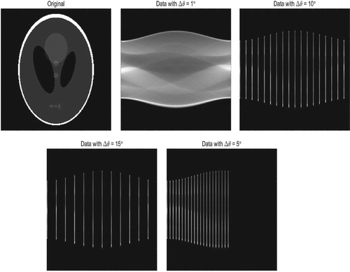 Figure 1. The original image and the projection data in sinogram form. The angular step size Δθ=1∘, 10∘, 15∘ (the total view angle is 180∘) respectively and total opening angle is 100∘, the angular step size Δθ=5∘. The missing parts of sinograms are denoted by black.