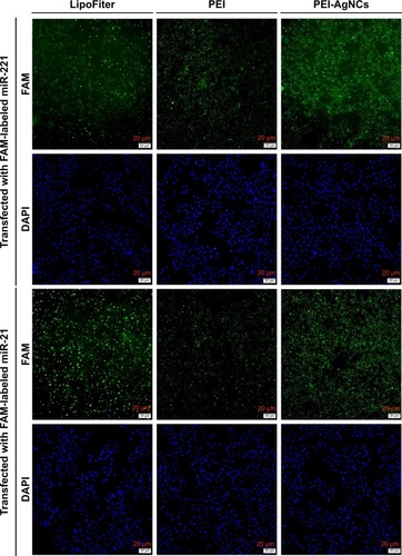 Figure 5 The inverted fluorescence microscopy images of HepG2 cells after exposure to different polyplexes for 12 hours. HepG2 cells were treated with LipoFiter/F-miR-21/221m, PEI/F-miR-21/221m, or PEI-AgNCs/F-miR-21/221m. The green fluorescence denotes the F-miRm and the blue fluorescence denotes the DAPI-stained cell nucleus. Scale bar, 20 µm.Abbreviations: PEI-AgNCs, polyethyleneimine-capped silver nanoclusters; F-miR-21/221m, FAM-labeled miR-21 or 221 mimics; F-miRm, FAM-labeled miRNA mimics; FAM, fluorescein amidite.