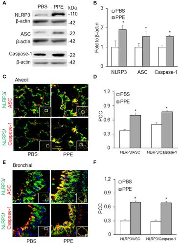 Figure 2 NLRP3 inflammasome formation in the lung. (A) Semiquantitative immunoblots reacted with anti-NLRP3, ASC, and caspase-1 antibodies, respectively. (B) Corresponding densitometric analyses of protein expression levels of NLRP3, ASC and caspase-1 normalized by β-actin. (n=3). Confocal microscopic analysis of NLRP3 inflammasome formation by examining NLPR3 colocalization with ASC or caspase-1 in the (C) alveoli and (E) bronchial wall of lung of mice receiving PPE or PBS instillation. (D and F) The Pearson correlation coefficient (PCC) for the colocalization of NLRP3 with ASC or caspase-1. (n=6). *P<0.05 vs PBS treatment.