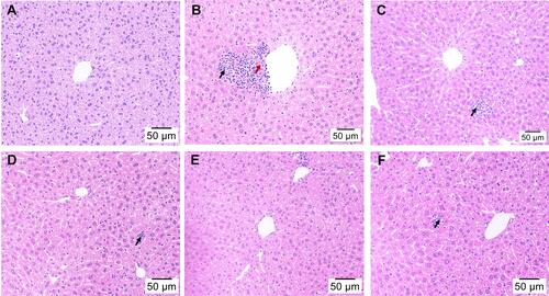 Figure 4 Effect of H2 on liver histopathological alterations in mice injured by D-Gal (H&E staining, magnification 200×). (A) Control group, (B) Model group, (C) 4% H2 group, (D) HRW group, (E) HRS group, and (F) Ator group. Black arrows indicate inflammatory cell infiltration and red arrow indicates necrosis.