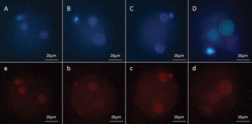 Figure 2. Fluorescent micrograph of zygotes labeled with 5-methylcytosine (5-mC). The pronuclei which are located near the secondary polar bodies, originated from oocytes and the others are the male pronuclei. (a) 3 hours after ICSI for normal semen sample, (b) 8 hours after ICSI for normal sample, (c) 3 hours after ICSI for low quality semen sample, and (d) 8 hours after ICSI for protamine deficient semen sample. Zygotes were also stained with Hoechst H33342, which are shown in the upper panels (corresponding uppercase letters).