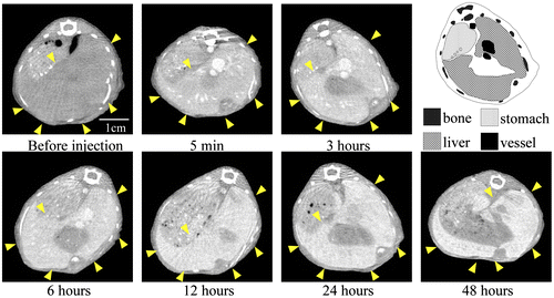 Figure 4. Change in CT value of a liver slice before and after injection of 30-nm Au-PEG. Yellow arrowheads indicate the region of the liver.