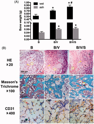 Figure 10. Ectopic bone formation induced by the GF-loaded composite hydrogels as shown in Table 3 at 4 weeks post-implantation; (A) Wet and ash weight of ectopic bone. *p < .05 is significant difference to the corresponding Group B; #p < .05 is significant difference to the corresponding Group B/V; (B) Histology and immunohistochemistry analysis of ectopic bone sections. Images in the first row are stained by Haematoxylin/eosin (HE) staining in 20×; Images in the middle row are stained by Masson’s trichrome staining in 100×; Images in the last row are stained by immunohistochemical CD31 staining in 400×.