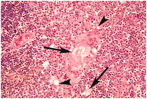 Figure 8. Thymus of broiler chick administered chlorpyrifos (20 mg/kg BW) at post-treatment Day 15. Representative photomicrograph shows condensed nuclei, vacuolar degeneration (arrow heads), myoid cells necrosis, and perforation of myoid cells (arrows). H&E stain. Magnification = 400×.