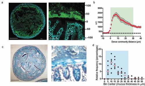 Figure 1. Dense band of bacteria forms overlying colonic mucosa