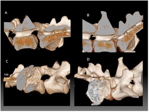 Figure 1 Three-dimensional reconstructions from CT data showing the lumbosacral junction of a German shepherd dog during flexion compared to extension. The vertebral column has been sectioned in the midline to only include the right half. (A) external detail of the LS junction in flexion, (B) internal detail of the LS junction in flexion, (C) external detail of the LS junction in extension, (D) external detail of the LS junction in extension.