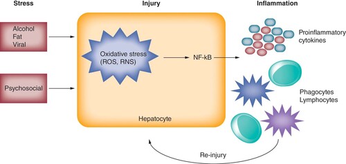 Figure 1. Hepatocyte injury-inflammation cycle from pathophysiological stressors.Alcohol, fat and viral infection are established hepatic stressors. Psychosocial stress may also lead to a similar pattern of hepatic injury. Pathophysiological stressors can trigger an oxidative stress reaction via overproduction of ROS and RNS. These oxidative species can precipitate NF-κB-mediated inflammatory pathways, leading to release of pro-inflammatory cytokines and recruitment of phagocytic cells (neutrophils and monocytes) and lymphocytes. This inflammatory milieu within the liver can lead to continued hepatocyte injury.RNS: Reactive nitrogen species; ROS: Reactive oxygen species.