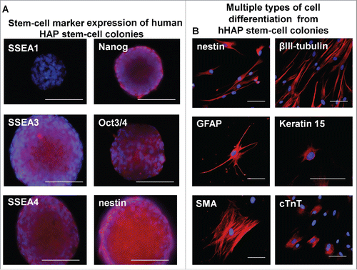 Figure 4. Stem-cell marker expression in hHAP stem-cell colonies and cells differentiated from them. (A) Stem-cell marker expression in hHAP stem-cells colonies. B) Two weeks after transfer to DMEM containing 10% FBS, the nestin-expressing hHAP stem-cell colonies differentiated to troponin (cTnT)-positive cardiac-muscle cells, nestin and βIII-tubulin-positive neurons, GFAP-positive glial cells, K15-positive keratinocytes and smooth-muscle actin (SMA)-positive smooth-muscle cells. Scale bar = 100 μm.