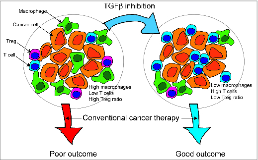 Figure 1. Immunotherapy to improve pre-treatment tumor immune environment to improve outcome with conventional cancer therapy. Patients bearing tumors with high macrophage infiltrates, low T cells infiltrates and high Treg:CD8+ ratios have been shown to have poor prognosis when treated with conventional therapies. Immunotherapy can change the infiltrates in tumors, and our studies with TGF® inhibition suggest this can improve outcome.