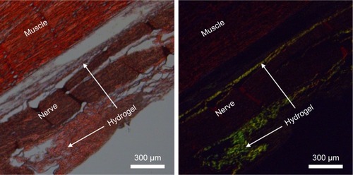 Figure 8 Congo red staining revealed distribution of RADA16-I nanofibers in vivo. Left: under normal light. Right: under polarized light.