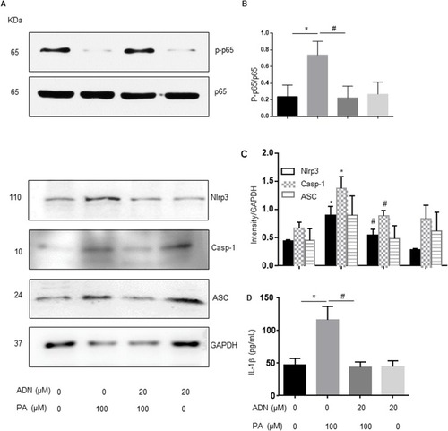 Figure 4 The effect of AdipoRon on ameliorating PA-induced expression of Nlrp3 inflammasome. H9c2 myocardial cells were incubated with PA (100 μM) in the absence and presence of indicated concentrations of AdipoRon (20 μM) for 18 h. Western blot analysis for protein levels of p-p65/p65 (A, B), Nlrp3, caspase-1 and ASC (A, C). The supernatant was detected according to manufacturer’s protocol by Elisa assay (D). Data are expressed as the mean ± SD. *P<0.05, #P < 0.05, vs PA group.