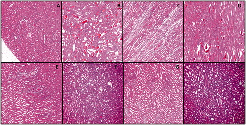 Figure 4. Hematoxylin and eosin results in rats’ kidney tissues; magnification 100X. A: Healthy B: GLY C: CM D: GLY + CM E: CM + EGCG 50 F: GLY + CM + EGCG 50 G: CM + EGCG 100 H: GLY + CM + EGCG 100