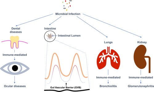 Figure 1. Immune responses affecting various organs during microbial infection.