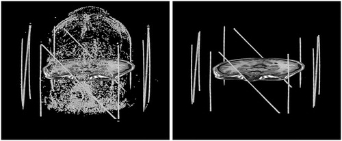 Figure 8. Blob selection (left) and cluster selection (right). Each cluster of blobs that corresponds to a tube undergoes principal component analysis. A single slice of the brain is shown for reference. It is typical for there to be some residual geometric distortion after correcting for the nonlinear gradient fields.