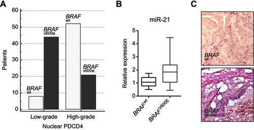 Figure 2 (A–C) High-grade nuclear PDCD4 expression results directly correlated with BRAF V600E mutation (A). Relationship between miR-21 expression levels by quantitative real-time PCR analysis and BRAF status. miR-21 overexpression in PTC directly correlates with BRAF V600E mutation (B). miR-21 was significantly up-regulated on in situ hybridization analysis in PTC samples carried BRAF V600E mutation by comparison with PTC BRAF wild type (wt) (C).Abbreviations: PDCD4, programmed cell death 4; PTC, papillary thyroid cancer.