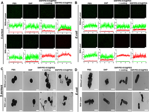 Figure 4 (A and B) The different groups’ (PBS, SNP, SNP/PEI-ICG@PEG + cooling, SNP/PEI-ICG@PEG, PBS + Laser, SNP + Laser, SNP/PEI-ICG@PEG + Laser + cooling, SNP/PEI-ICG@PEG + Laser) inverted fluorescence images of live/dead S. aureus and E. coli after treatment and fluorescence intensity quantization (The concentration of each drug was 450 μg/mL; scale bar=50 μm); (C) TEM images of S. aureus in the different treatment groups (PBS, SNP, SNP/PEI-ICG@PEG + cooling, SNP/PEI-ICG@PEG, PBS + Laser, SNP + Laser, SNP/PEI-ICG@PEG + Laser + cooling, SNP/PEI-ICG@PEG + Laser; The concentration of each drug was 450 μg/mL; scale bar=1 μm); (D) TEM images of E. coli in the different treatment groups (PBS, SNP, SNP/PEI-ICG@PEG + cooling, SNP/PEI-ICG@PEG, PBS + Laser, SNP + Laser, SNP/PEI-ICG@PEG + Laser + cooling, SNP/PEI-ICG@PEG + Laser; The concentration of each drug was 450 μg/mL; scale bar=2 μm).