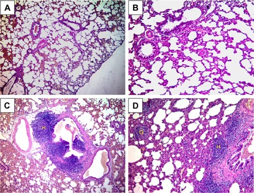 Figure 3 Structural changes in rat lungs following exposure to GNPs and/or SMFs.Notes: (A) Normal structure of lungs in control rats. (B) Normal structure of lungs in rats exposed to SMFs for 14 days. (C) Lung structure of GNPs-treated rats. (D) Lung structure of coexposed rats to GNPs and SMFs. ×100 magnification.Abbreviations: G, granuloma; GNPs, gold nanoparticles; H, hyperplasia; SMFs, static magnetic fields.
