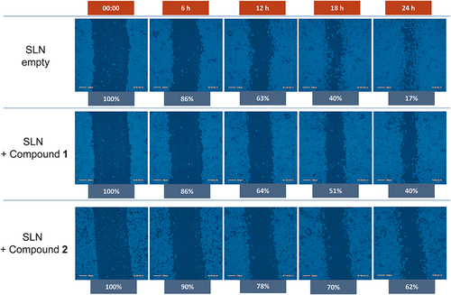 Figure 8 Representative images obtained from wound healing assay against MDA-MD-231 breast cancer cell line for encapsulated form of compound 1 and 2 at concentration of active substances 10 µM.