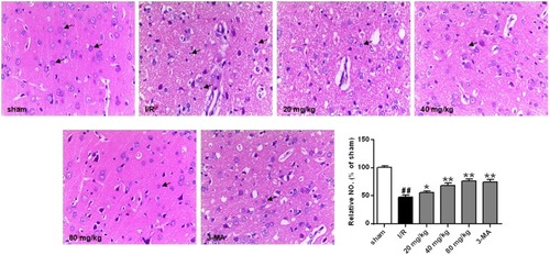 Figure 3 Effects of different doses of stigmasterol on histopathological alteration following cerebral ischemia/reperfusion injury (200×). After deep anesthetization with chloral hydrate, rat brain was immediately removed and immersed in 10% phosphate-buffered formalin for 12 hrs, then embedded in paraffin. Brain tissues of 5 μm were stained with HE and visualized. Arrows in the sham group, denoting the normal neurons; in ischemia/reperfusion group, the physiological abnormality; in stigmasterol-treated groups, the recovering neurons. The abnormal neurons were counted and expressed relatively to the sham group. n=6. ##p<0.01 vs sham group; *p<0.05, **p<0.01 vs ischemia/reperfusion group.