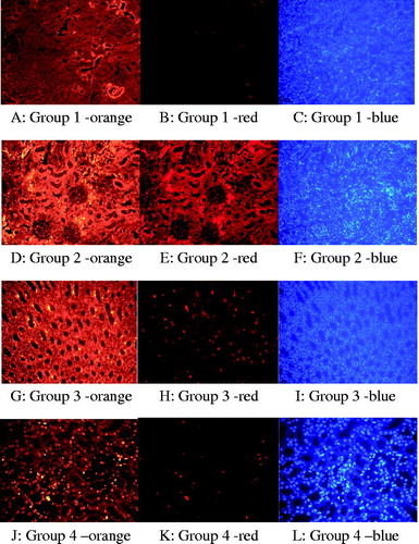 Figure 3. Immuno-fluorescent findings: Insitu BrdU DNA fragmentation; (A) scarce apoptotic cells at the tubulus epithelium in the Control Group (orange; ×200). (B) (red; ×200). (C) (blue; ×200). (D) Apoptotic cells that display significant signal density at the tubulus epithelium in the Colistin Group (orange; ×200). (E) (red; ×200). (F) (blue; ×200). (G) Apoptotic cells that display sparse signal density at the tubulus epithelium in the Luteolin group (orange; ×200). (H) (red; ×200). (I) (blue; ×200). (J) Apoptotic cells that display sporadic intensive signal density at the tubulus epithelium in the Colistin Group + Luteolin Group (orange; ×200). (K) (red; ×200). (L) (blue; ×200).