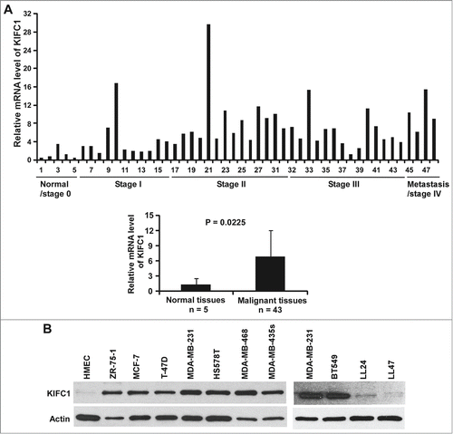 Figure 1. KIFC1 is upregulated in human breast cancer. (A) Breast cancer TissueScan Real-Time qPCR array was analyzed for KIFC1 expression by real-time PCR. The relative levels of KIFC1 expression are plotted with clinical status. (B) KIFC1 expression in human normal mammary epithelial cells (HMEC), 8 breast cancer cell lines and 2 human lung fibroblast cell lines LL24 and LL47 was examined by Western blotting. Samples were also probed with the anti-actin antibody to verify equal loading.