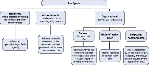 Figure 6: Management of amblyopia