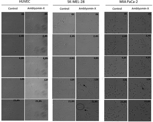 Figure 2. Modulation of cellular migration by Amblyomin-X. Cell migration assays were performed in time lapse (In Cell Analyzer 2200) during 24 hours of treatment with 20 μM Amblyomin-X. The arrows highlight cell extensions and circles emphasize the change in cell morphology. Movies are available in the supplementary material.