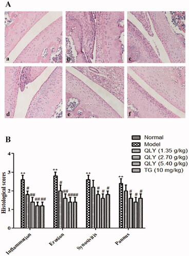 Figure 4. Effects of QLY granules on histopathology of AA joints. The histopathology examinations in joints were observed by H&E staining. (A) Representative histological changes of haematoxylin and eosin-stained sections of the joints (magnification × 400). a: normal; b: model; c: QLY granules (1.35 g/kg); d: QLY granules (2.70 g/kg); e: QLY granules (5.40 g/kg); f: TG (10 mg/kg). (B) Histopathological evaluation of the synovium from the AA rats. The histological appearance was scored for the presence of synovial proliferation, infiltrated inflammatory cells, pannus formation, and cartilage erosion. Data are expressed as the mean ± SD, with 5 animals in each group. **p < 0.01 vs. normal; #p < 0.05, ##p < 0.01 vs. model.