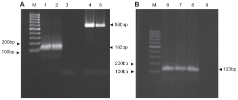 Figure 1 Conventional and nested polymerase chain reaction products of Mycobacterium tuberculosis IS6110 fragment by agarose gel electrophoresis (2%). (A) Nested polymerase chain reaction, M 100 bp DNA size marker, (second round) (1) positive control, (2) clinical positive sample, (3) negative control (first round), (4) positive control, (5) clinical positive sample. (B) Conventional polymerase chain reaction, (6) positive control, (7, 8) positive clinical samples, (9) negative control.