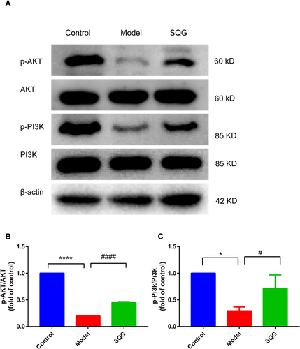 Figure 7 SQG activated PI3K/AKT signaling pathway against NS. (A) Expressions of protein AKT, p-AKT, PI3K and p-PI3K were determined by Western blotting. (B) Quantitative analysis of p-AKT/AKT expression ratio. (C) Quantitative analysis of p-PI3K/PI3K ratio. Data are shown as mean ± s.d. *p < 0.05, ****p < 0.0001, vs Control group. #p < 0.05, ####p < 0.0001 vs Model group. n=3 samples per group.