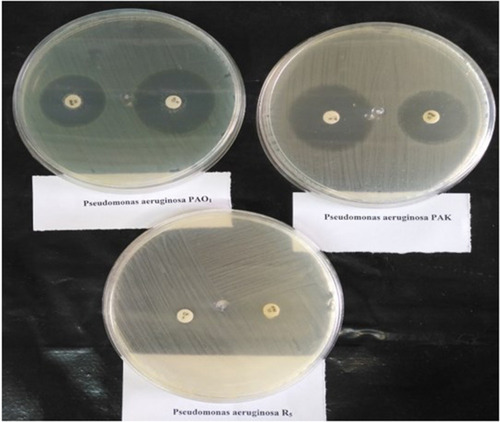 Figure 5 Bacterial resistance tested by the disc diffusion method on the Pseudomonas aeruginosa strains of PAO1, PAK, and R5. R5 hospital strain was resistant to ciprofloxacin 5 μg and imipenem 10 μg.