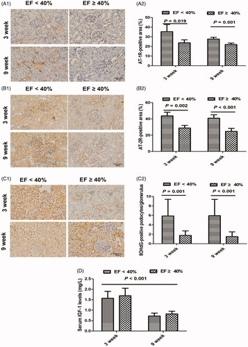 Figure 5. Potential modulators involved in renal injury in myocardial infarction rats at 3 and 9 weeks. (A1) Immunohistochemical staining for AT-1R at 3 and 9 weeks. (A2) The relative percentage of AT-1R-stained area within and surrounding the glomerulus at 3 and 9 weeks. (B1) Immunohistochemical staining for AT-2R at 3 and 9 weeks. (B2) The relative percentage of AT-2R-stained area within and surrounding the glomerulus at 3 and 9 weeks. (C1) Immunohistochemical staining for 8-OHdG-positive podocytes at 3 and 9 weeks. (C2) The average number of 8-OHdG-positive podocytes per glomerulus at 3 and 9 weeks. (D) Serum insulin-like growth factor-1 (IGF-1) levels at 3 and 9 weeks. AT-1/2R: angiotensin II type 1/2 receptor; 8-OHdG: 8-hydroxy-2′-deoxyguanosine; EF: ejection fraction; original magnification, ×200.