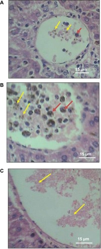 Figure 1 H&E stained liver sections showing profiles of central veins of (A) infected mouse given cocoa and (B) infected mouse not given cocoa containing parasitized RBCs (yellow arrows) and phagocytosed parasitized RBCs (red arrows). Central vein of control mouse (C) contain unparasitized RBCs (yellow arrows).