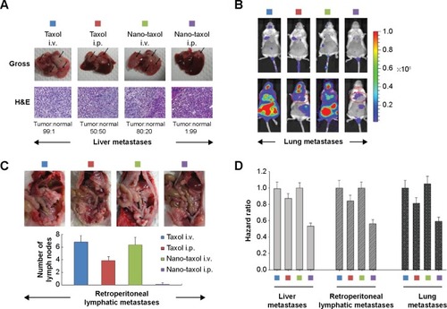 Figure 3 Regional delivery of Nano-taxol suppresses vital organ metastases.Notes: (A) Control of liver metastases. Liver metastasis was induced in the mice by injection of tumor cells into the spleen on day 1. The mice in the indicated groups (n=5 in each group) received their treatments on days 8, 11, and 14. The livers were retrieved on day 18. Regional (intraperitoneal) delivery of Nano-taxol demonstrates the best control of liver metastases. Representative figures are shown. The arrow indicates the tumor (upper panel). H&E staining of the liver showing the ratio of tumor versus normal tissue (lower panel). (B) Control of lung metastases. Lung metastases were induced in the mice by a tail vein injection of tumor cells on day 1. The mice administered regional (intrapleural) delivery of Nano-taxol demonstrate the best control of lung metastases. Intrapleural delivery of Nano-taxol demonstrates not only satisfactory suppression of lung metastases but also suppression of intraperitoneal metastases. Hence, regional delivery of nanomedicine can be viewed as a treatment that involves the concept of a drug reservoir. Sustained-release of free drug from a reservoir effectively controls local (lung) metastases and also distant (intraperitoneal) metastases. (C) Control of retroperitoneal lymph node metastases. Retroperitoneal lymph node metastasis was induced in mice by injection of tumor cells on day 1. The mice in the different groups received the indicated treatment on days 8, 11, and 14 and were sacrificed on day 18. Regional (intraperitoneal) delivery of Nano-taxol demonstrated the best control of metastases to retroperitoneal lymph nodes (upper panel. Arrows indicate enlarged lymph nodes). The number of lymph nodes was counted (lower panel). The experiments were performed in triplicate. (D) Summary of the hazard ratio of overall survival for each type of vital organ metastasis.Abbreviations: H&E, hematoxylin and eosin; i.p., intraperitoneal; i.v., intravenous.