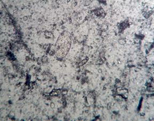 Figure 5 Paramphistomum egg.