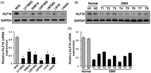 Figure 1. KLF16 expression is reduced in glioma tissues and cell lines. (A and B) Western blotting analysis of KLF16 expression in normal human astrocyte (NHA) cells and 6 glioma cell lines (A) and in two normal brain tissues and eight human glioma tissues (B). GAPDH served as the loading control. (C and D) Real-time PCR analysis of KLF16 expression in NHA and 6 glioma cell lines (C) and in two normal brain tissues and eight human glioma tissues (D). Transcript levels were normalized to GAPDH expression. *p < .05 vs. NHA cells.