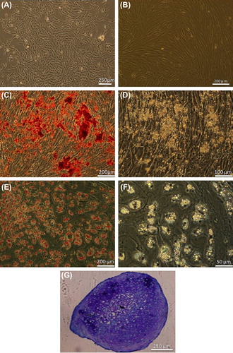 Figure 3. Human MSC culture and differentiation. (A) Bone marrow cell at primary culture. (B) Confluent culture of passaged-3 cells. (C) Alizarin red staining of the osteogenic culture. (D) The same osteogenic culture without staining. (E) Oil red staining of the adipogenic culture. (F) Adipogenic culture without staining. (G) Toluidine blue staining of chondrogenic culture.