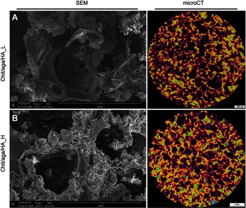 Figure 1 (A) Microstructure of the biomaterials visualized by SEM (magnification 250x, scale bar =1 mm). (B) MicroCT cross-section images presenting porosity of the scaffolds (black color – pores, yellow/orange/green – nanohydroxyapatite ceramics, violet – polysaccharide matrix).Abbreviations: SEM, scanning electron microscopy; microCT, microcomputed tomography; chit/aga/HA_L, chitosan/agarose/nanohydroxyapatite scaffolds with low [40 wt%] nanohydroxyapatite content; chit/aga/HA_H, chitosan/agarose/nanohydroxyapatite scaffolds with high [70 wt%] nanohydroxyapatite content.