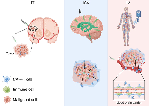 Figure 1 Transport paths of CAR T cells under different injection modes.