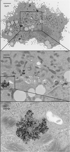 Figure 3. Gold nanoparticle internalisation by SNU449 cells. Transmission electron microscopy images demonstrating uptake of C225-AuNPs (100 µg/mL) by SNU449 cells after 4 h of treatment.