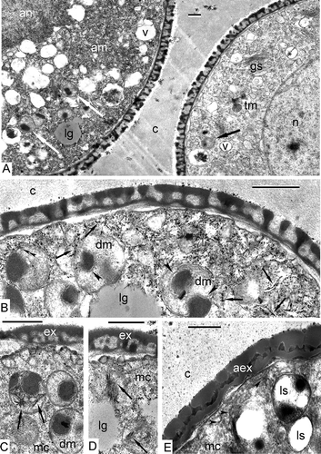 Figure 6. Deviating microspores at the late tetrad stage in Chamaedorea microspadix. A. Some microspores, observed in tetrads, deviate from the normal development and have a much denser cytoplasm (on the left: am – atypical microspore) in comparison to normal ones (on the right: tm – typical microspore). They also have a much denser atypical nucleus (an). Many double-membrane organelles with dark-contrasted inclusions are seen in both normal and deviating microspores (white and black arrows). B. This higher magnification shows that the cytoplasm of such microspores is packed with dark-contrasted thread-like inclusions in association with small roundish particles, so-named “strings of beads” (arrows). In some places, these strings cross the restricting membranes of organelles (double arrowhead). A dark-contrasted substance associated with double-membrane organelles (plastids or dedifferentiated mitochondria) is separated from the body of these organelles by a double membrane (arrowheads) and is located inside invaginations of double membrane. C, D. Needle-shaped or star-shaped formations are observed in the stroma of double-membrane organelles (arrows). E. At the same stage, microspores with untypical massive exine are seen. Double-membrane organelles with associated dark-contrasted inclusions are converted into lysosomes (ls). They first lose the inner membrane and then gradually lose their dark inclusions. Strings in the cytoplasm are less discernible (arrowheads). Legend to all figures: aex – atypical exine, c – callose, dm – double-membrane organelles, ex – exine, gs – Golgi stack, lg – lipid globule, mc – microspore cytoplasm, n – nucleus, v – vacuole. Scale bars – 0.5 μm.