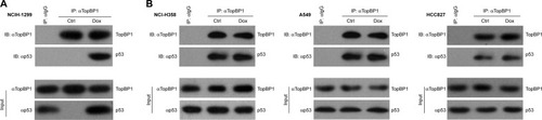 Figure 5 Upregulation of p53 by topoisomerase IIβ binding protein 1 (TopBP1) in NCI-H1299 cells.