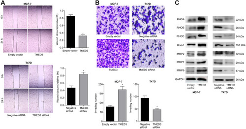 Figure 6 Effects of overexpression and knockdown of TMED3 on the migration and invasion of breast cancer cells.Notes: (A) Wound healing assay showing migration of MCF-7 and T47D cells (400×). (B) Transwell invasion assay showing the invasion of MCF-7 and T47D cells (400×). (C) Western blot analysis showing the expression of relevant migration-related proteins in MCF-7 and T47D cells. *P<0.05.