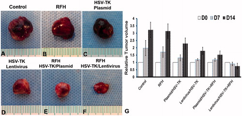 Figure 5. Histology of tumours. Representative tumours harvested from six different animal groups, showing the smallest tumour size treated by combination therapy (lentivirus/HSV-TK + GCV plus RFH), compared with other treatments.