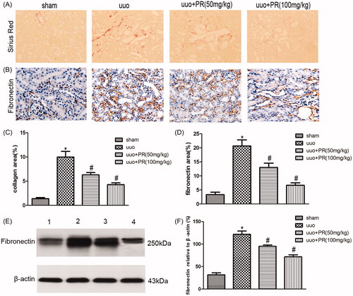 Figure 2. Effects of puerarin treatment in interstitial ECM after UUO in mouse. (A) Representative photomicrographs showing collagen area under Sirius red staining in the four groups: sham, UUO, UUO +50 mg/kg PR, and UUO +100 mg/kg PR. (B) Immunohistochemistry staining of fibronectin are shown in the four groups: sham, UUO, UUO +50 mg/kg PR, and UUO +100 mg/kg PR. (C and D) Semiquantitative analysis of interstitial collagen and fibronectin area. (E) Representative Western blots gels for fibronectin. Numbers 1, 2, 3, and 4 correspond to sham, UUO, UUO +50 mg/kg PR, and UUO +100 mg/kg PR groups, respectively. (F) Semi-quantitative analysis of the fibronectin area. *p < .05 compared with the sham group; #p < .05 compared with the UUO group (magnification, ×200).
