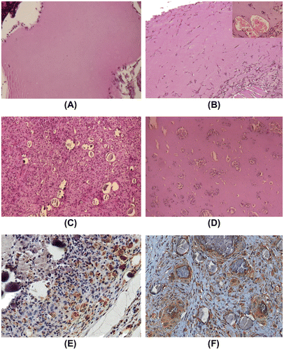 Fig. 6. In vivo osteogenic effect of SBCD in Matrigel plus hydroxyapatite at day 20.Notes: Matrigel was mixed with 0.1 mg/mL SBCD and 0.6% hydroxyapatite and subcutaneously injected in mice. (A–B) Representative hematoxylin/eosin staining showing a modest effect of SBCD alone (B) as compared to vehicle (A). SBCD induced a slight cellular infiltrate (B), with some vessels (B, inset). (C–D) Representative hematoxylin/eosin staining showing a dense cellular infiltrate after 20 days in plugs containing SBCD plus hydroxyapatite (C) and not hydroxyapatite alone (D). (E–F) Representative micrographs showing the immunohistochemical staining of F4/80+ macrophages surrounding the crystals (E) and osteocalcin deposition (F) in Matrigel plugs containing 0.1 mg/mL SBCD and 0.6% hydroxyapatite. Original magnification: A–D: ×100; E and F: ×200.