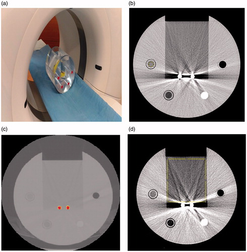 Figure 2. Experiment set up. (a) The phantom was placed on the platform of a CT scanner. Titanium rods were placed in the center of the groove, and the groove was filled with water. CT scanners from three manufacturers were used to perform CT scans. (b) Cross-section of the phantom. The acrylic tube to the upper right of the titanium rods is filled with air; the other materials, in clockwise order, are a mixture of water and contrast medium, fat, and water. (c) CT image of the titanium rods, which are indicated in red. The threshold value was set to be half the maximum HU for two titanium rods. (d) Fraction of affected pixel area (FAPA) in the CT image. The measured area was the rectangle area of water (10,000 mm2) above titanium rods. FAPA was defined as the percentage of pixels with CT number higher than 20 HU or lower than −20 HU inside the rectangle area.