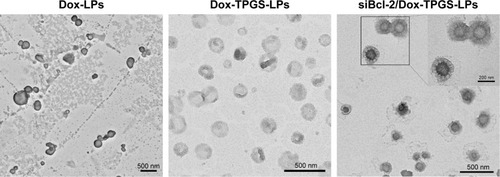 Figure 1 TEM images of Dox-LPs, Dox-TPGS-LPs, and siBcl-2/Dox-TPGS-LPs stained with phosphotungstic acid.Note: Scale bar represents 500 nm.Abbreviations: Dox, doxorubicin; LPs, liposomes; siBcl-2, Bcl-2 siRNA; TEM, transmission electron microscopy; TPGS, D-α-tocopherol polyethylene glycol 1000 succinate.