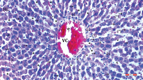 Figure 6. Light microscopic view of liver tissue of group IR-FC60-Sevo (HL: hepatic lobules; VC: vena centralis; e: erythrocyte; *: sinusoid dilatation; ↓↓: infiltration; →: hepatocyte; k: kupffer cell hyperplasia; (*): necrotic and apoptotic appearance in hepatocytes), H&EX100.